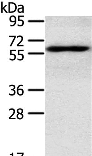 RORA / ROR Alpha Antibody