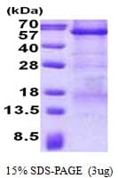 Human CPE / Carboxypeptidase E Protein (Recombinant His)