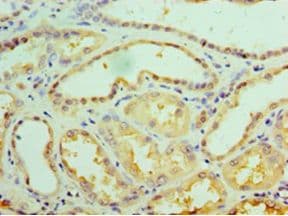 GALE / UDP-Glucose 4-Epimerase Antibody (aa1-348, HRP)