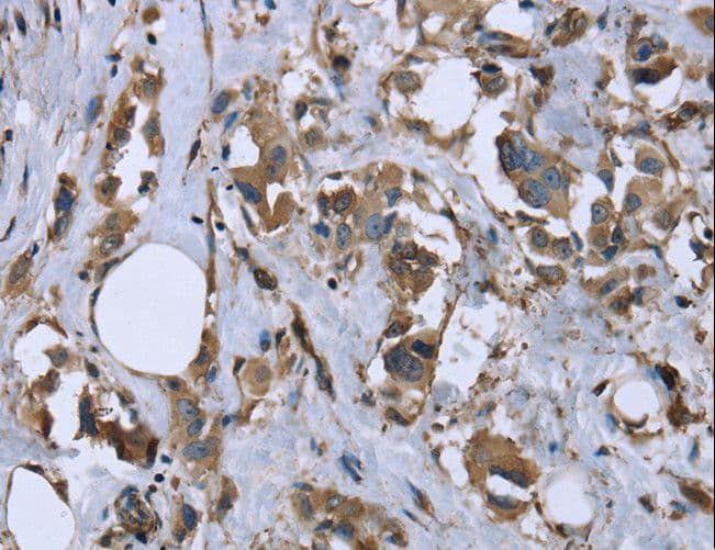 MRLC2 / MYL12B Antibody