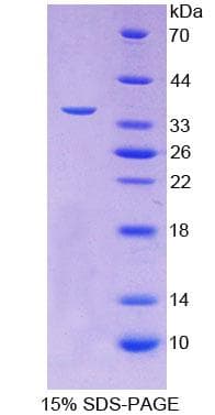 Human FSTL1 Protein (Recombinant His-T7)