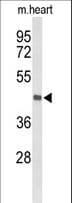 BRINP1 / DBC1 Antibody (aa85-111)