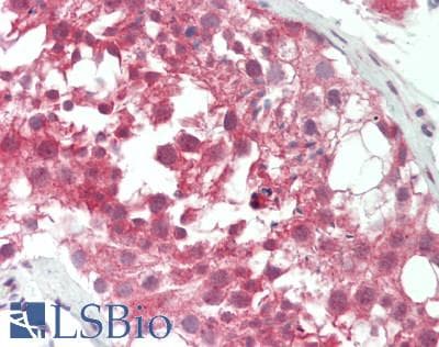 Polyclonal Rabbit anti-Human BRDT Antibody (N-Terminus, IHC, WB)
