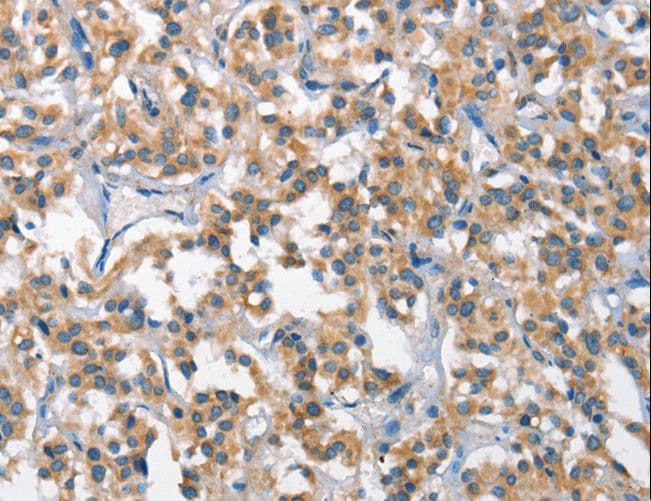 SCARB1 / SR-BI Antibody