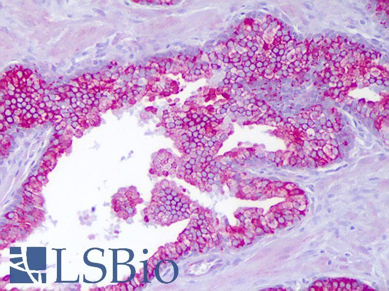 IHC-plus™ Polyclonal Rabbit anti-Human PTTG1IP / PBF Antibody (aa116-165, IHC, WB)