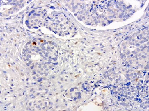 SERPINB4 / SCCA1+2 Antibody (clone UMAB16, Carrier-free)
