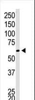 CBX4 Antibody (aa410-437)