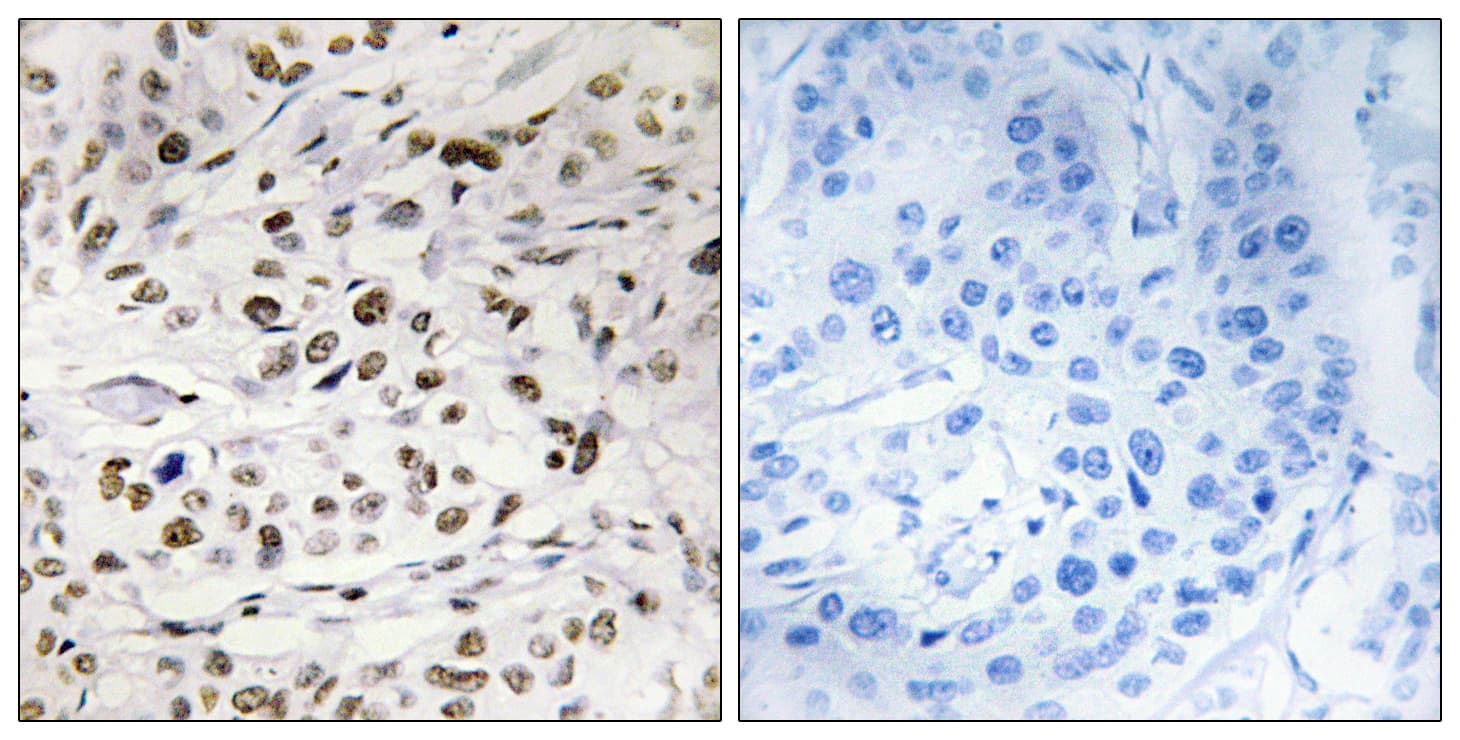 HMGN1 / HMG14 Antibody (phospho-Ser21)