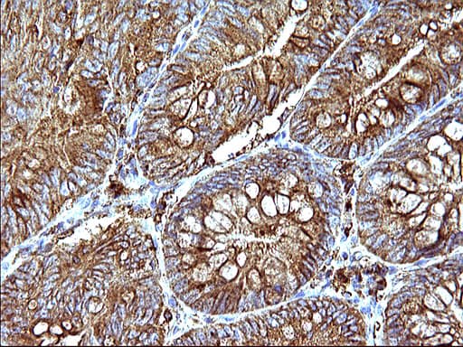 Monoclonal Mouse anti-Human SCAMP2 Antibody (clone OTI1H10, IHC, WB)