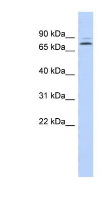 Polyclonal Rabbit anti-Human KLHL14 Antibody (aa71-120, WB)