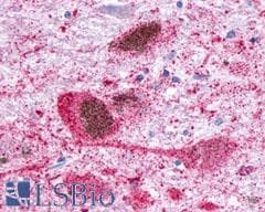 PathPlus™ GPR34 Antibody (C-Terminus)