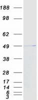 Human CCDC78 Protein (Recombinant Myc-DDK (Flag))