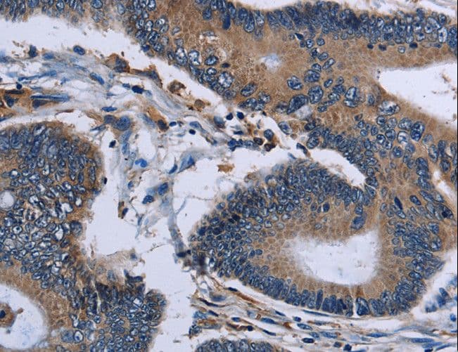IPO4 Antibody
