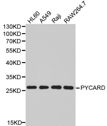 IHC-plus™ PYCARD / ASC / TMS1 Antibody