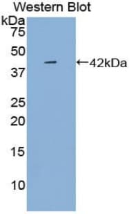 CXCL4 / PF4 Antibody (aa30-105)
