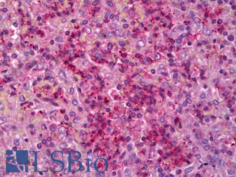 IHC-plus™ IL6R / IL6 Receptor Antibody