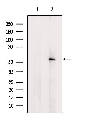 FADS1 Antibody