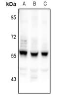 Polyclonal Rabbit anti-Human CEP55 Antibody (IHC, WB)