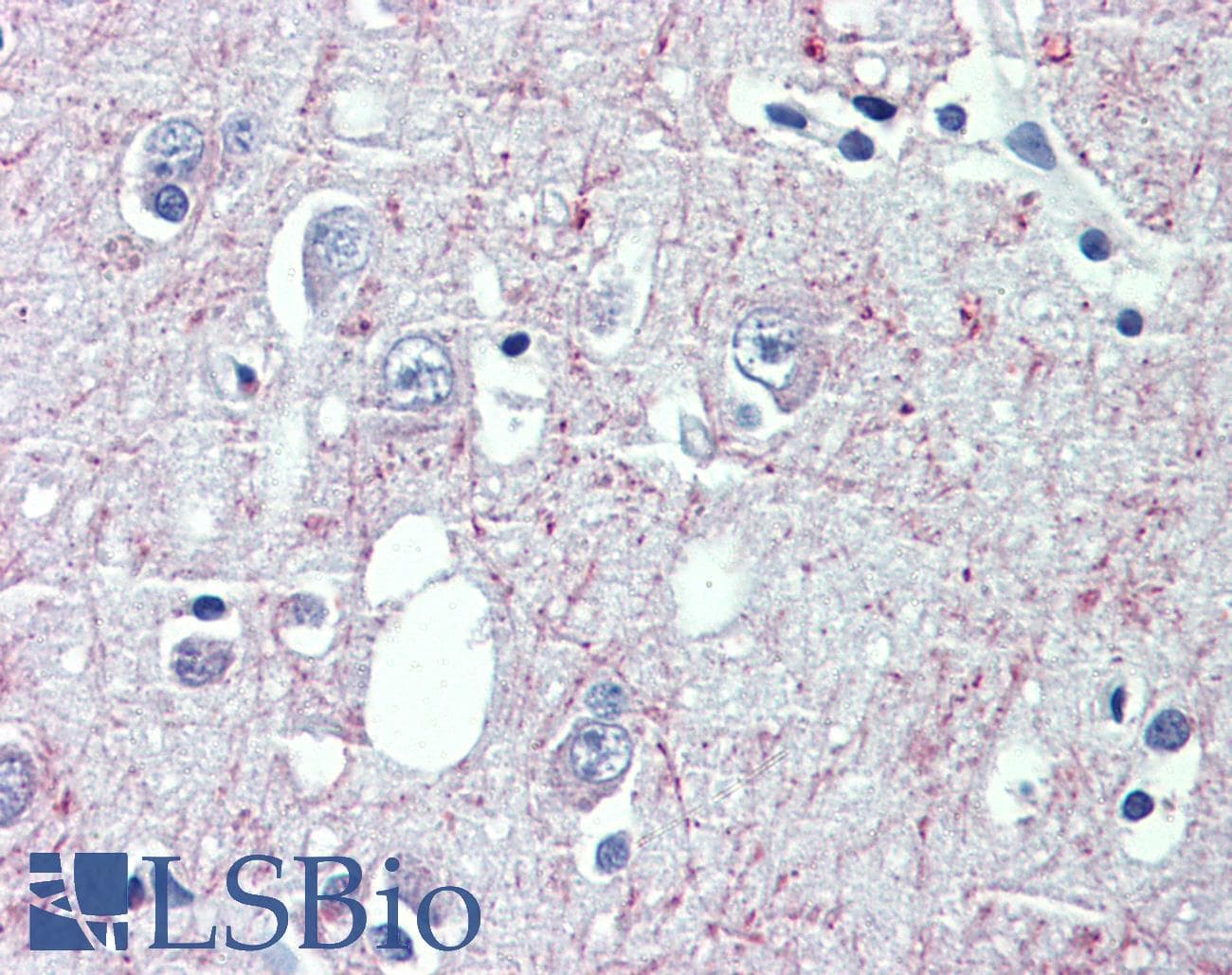 IHC-plus™ Polyclonal Goat anti-Human GABBR1 / GABA B Receptor 1 Antibody (aa947-961, IHC)