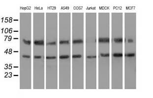 HSPA6 / HSP70B' Antibody (clone OTI1H3)