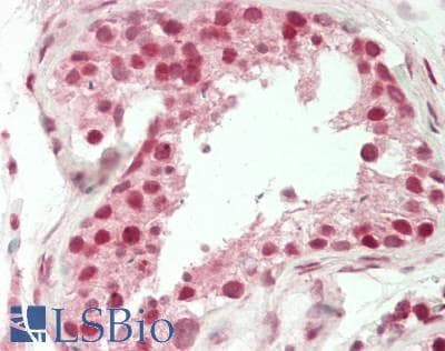 IHC-plus™ ARID4B Antibody (aa125-175)