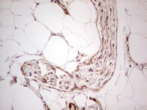 UBE2D2 / UBCH5B Antibody (clone OTI2C2)