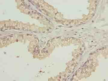 Polyclonal Rabbit anti-Human WDR91 Antibody (IHC)