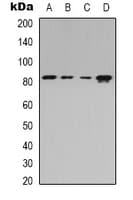 ADD2 Antibody (Internal)