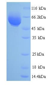 California poppy Reticuline Oxidase Protein (Recombinant His)
