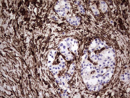 Monoclonal Mouse anti-Human Vimentin Antibody (clone UMAB160, IHC, IF, WB)