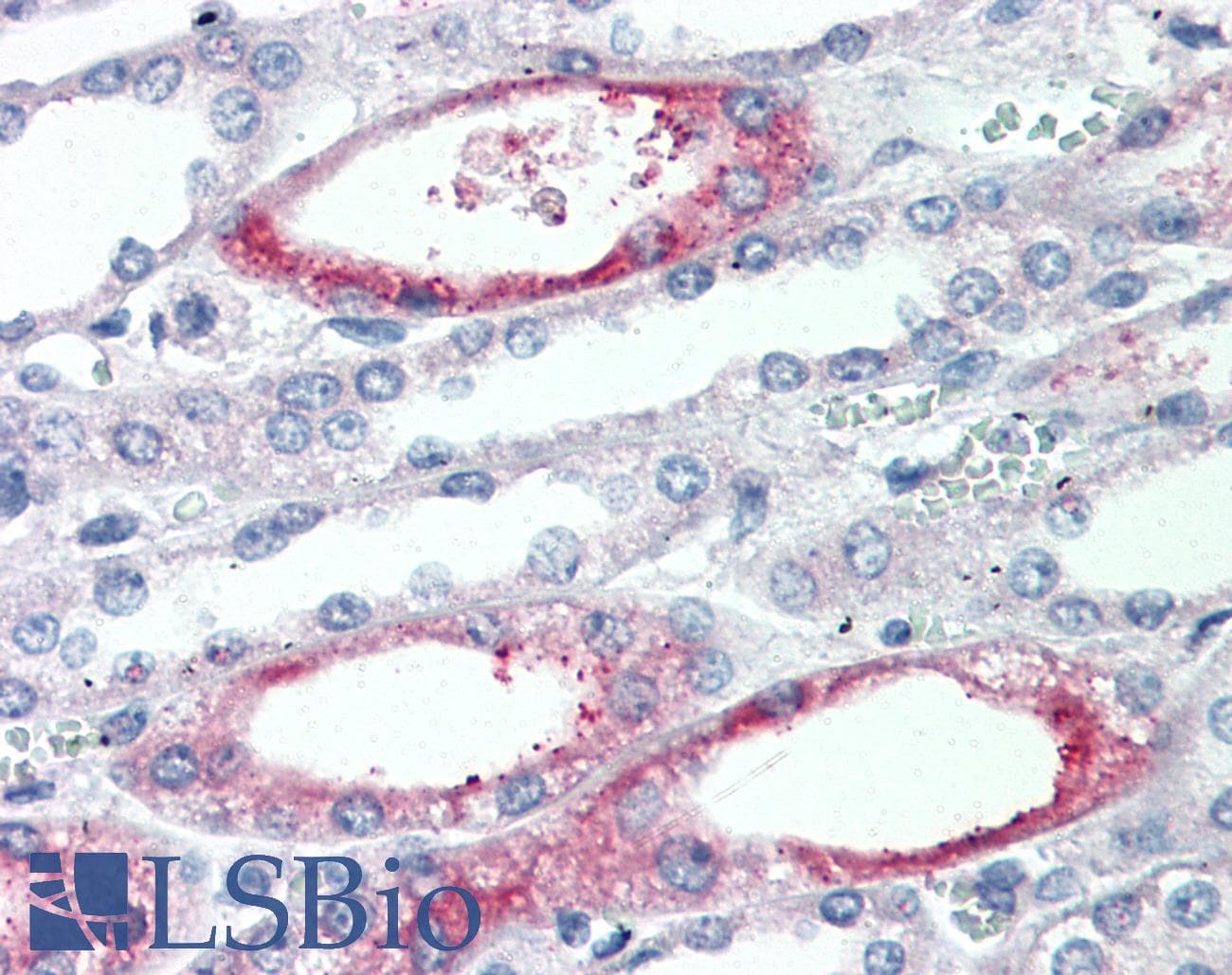 IHC-plus™ PIGR Antibody (Extracellular Domain)