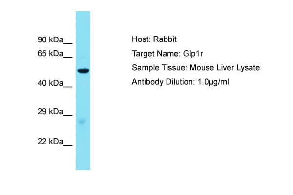 GLP1R / GLP-1 Receptor Antibody (aa101-150)