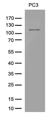 TRPM8 Antibody (aa1-300, clone OTI7A11)