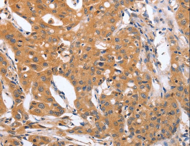 BLNK Antibody