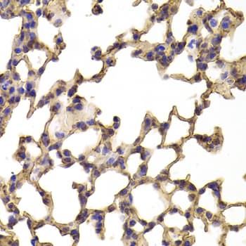 TPP2 Antibody