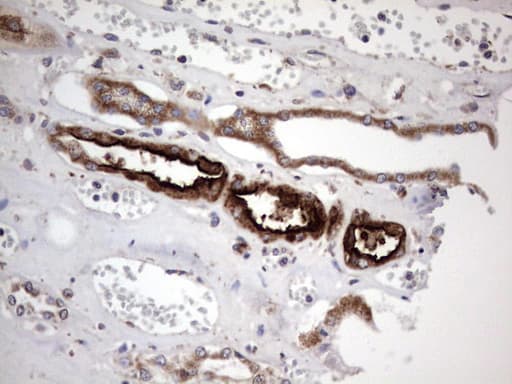 Monoclonal Mouse anti-Human ACE2 / ACE-2 Antibody (clone OTI4D2, aa18-237, IHC, WB)
