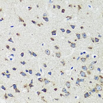 Polyclonal Rabbit anti-Human CCDC124 Antibody (IHC)
