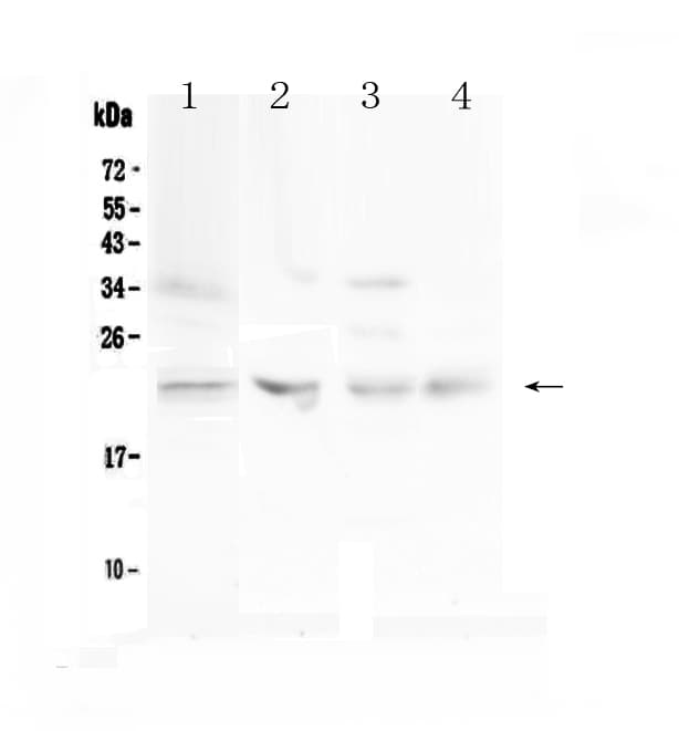 TIMP1 Antibody