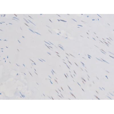SMAD3 Antibody (phospho-Ser213)