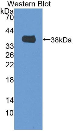 MTFMT Antibody (aa78-386, PE)