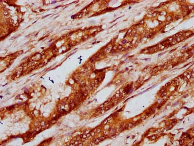 Polyclonal Rabbit anti-Human HIST1H4I Antibody (IHC)
