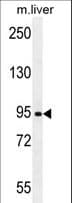 AASS / LKR / SDH Antibody (aa264-294)
