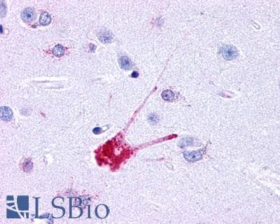 PathPlus™ Polyclonal Rabbit anti-Human TACR1 / NK1R Antibody (Extracellular Domain, IHC)