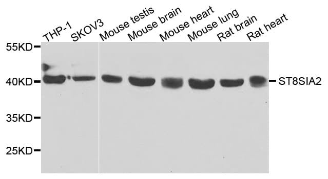 IHC-plus™ ST8SIA2 / STX Antibody