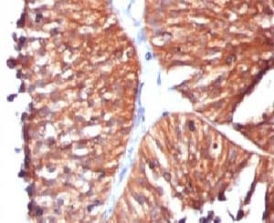 HSPD1 / HSP60 Antibody (clone SRPR60)