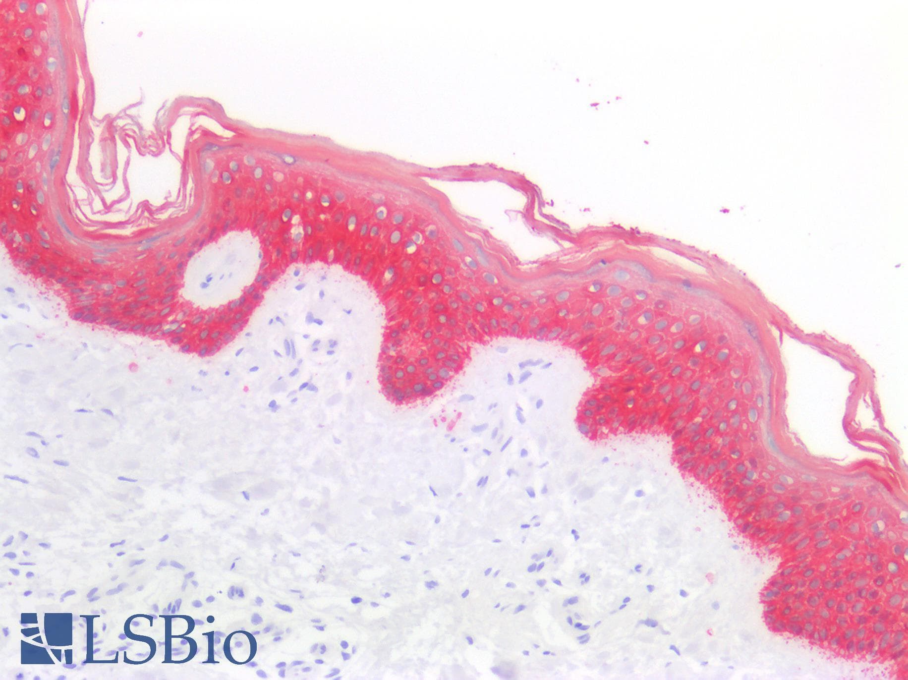 IHC-plus™ Monoclonal Mouse anti-Human KRT5 / CK5 / Cytokeratin 5 Antibody (clone OTI1C7, IHC, WB)