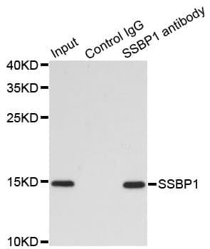 PathPlus™ SSBP1 / mtSSB Antibody