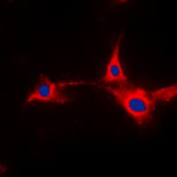 PFKFB2 Antibody (N-Terminus)