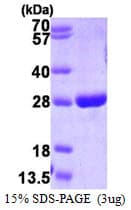 Human GSTP1 / GST Pi Protein (Recombinant His)
