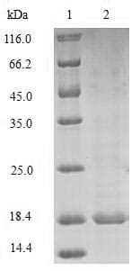 Mouse PRND / DOPPEL Protein (Recombinant 10His, N-terminus + Myc, C-terminus)